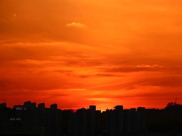 연세사랑병원이 개발한 한국형 맞춤형 인공관절 PNK